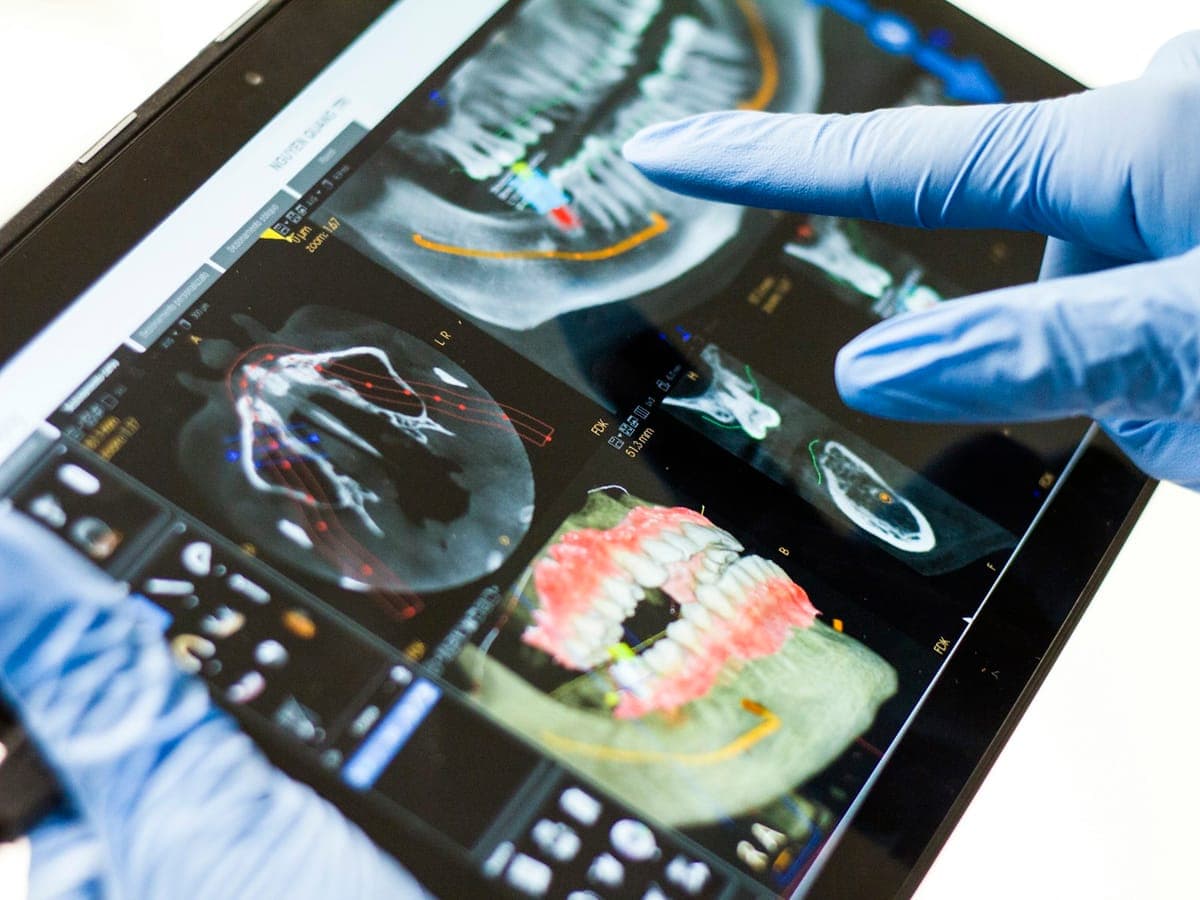 Scanner intraorale